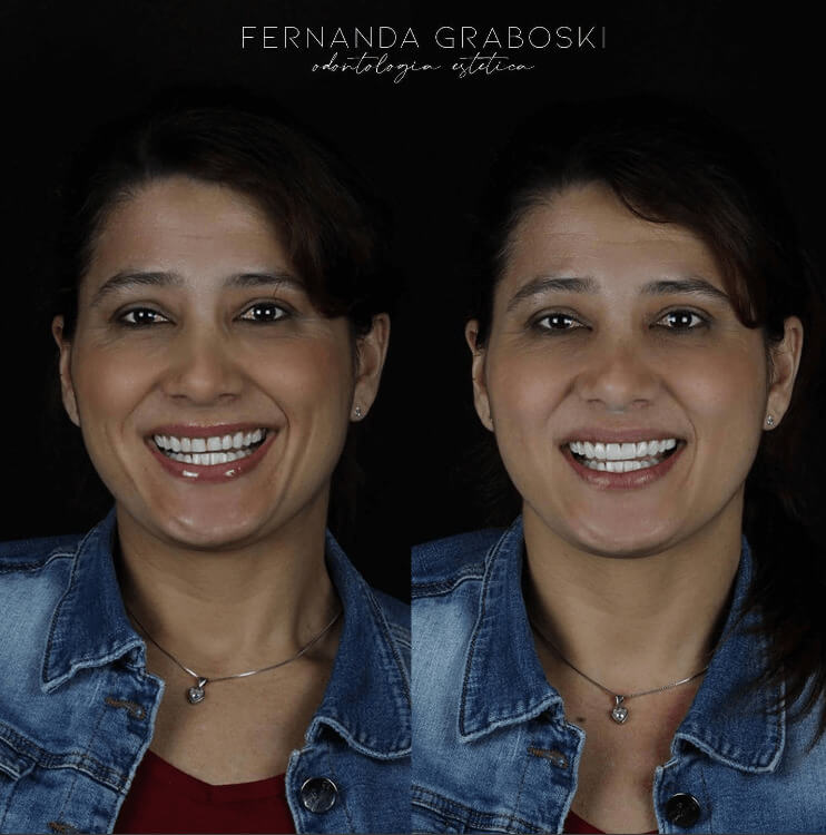 Caso 02 · Dra. Fernanda Graboski