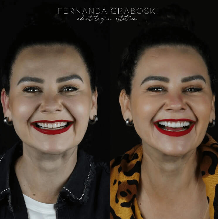 Caso 04 · Dra. Fernanda Graboski