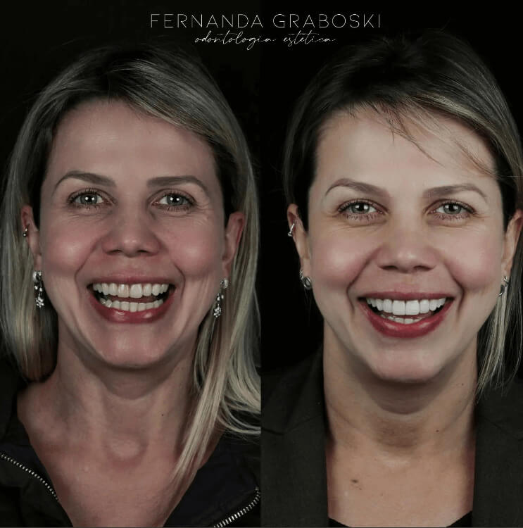 Caso 05 · Dra. Fernanda Graboski