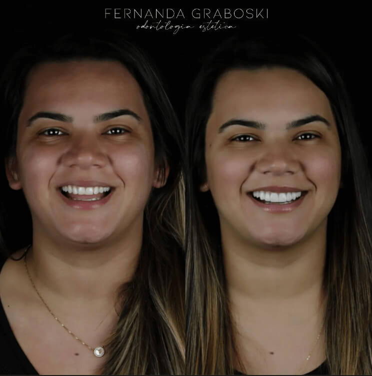 Caso 06 · Dra. Fernanda Graboski